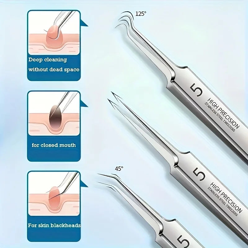 Kit Extracteur de Comédons — Pince Ultra-Fine Anti-Points Noirs & Acné